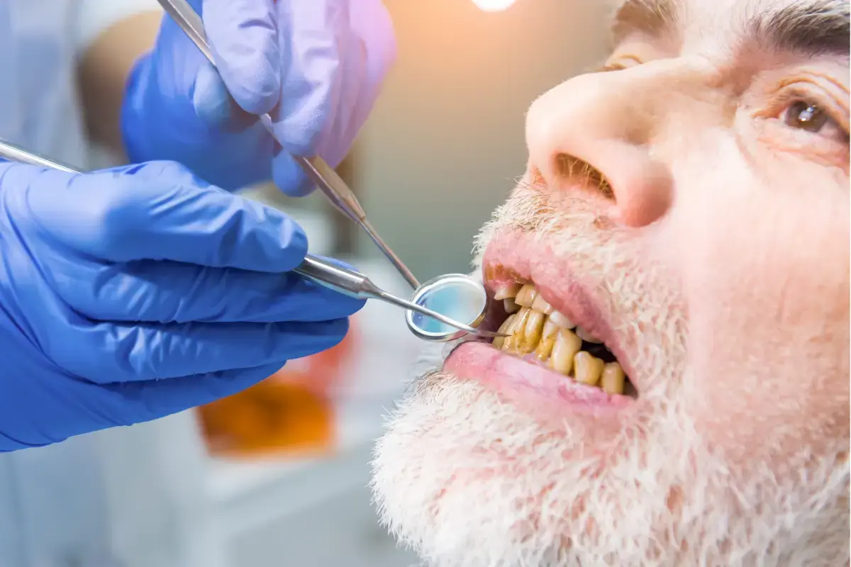 Dentist examining discolored tooth with dental mirror and tools during examination.